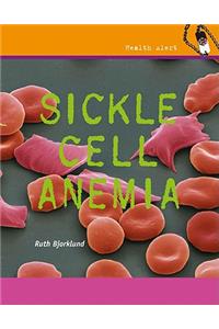 Sickle Cell Anemia