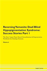 Reversing Yemenite Deaf-Blind Hypopigmentation Syndrome