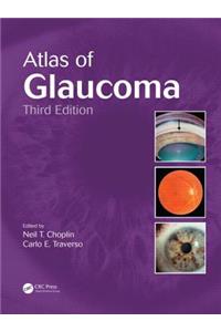 Atlas of Glaucoma