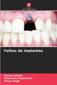Falhas de implantes