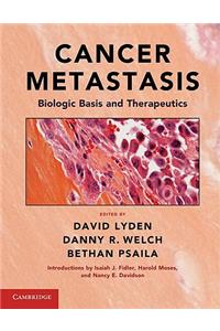 Cancer Metastasis