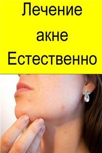 Cure Your Acne Naturally (Russian)