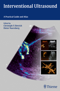 Interventional Ultrasound