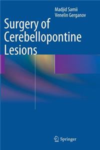 Surgery of Cerebellopontine Lesions