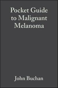 Pocket Guide to Malignant Melanoma