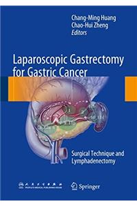 Laparoscopic Gastrectomy for Gastric Cancer