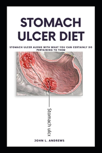 Stomach Ulcer Diet