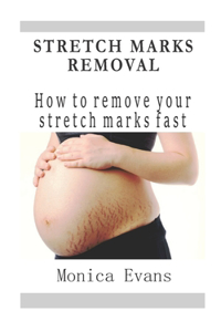 Stretch Marks Removal