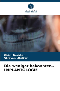 weniger bekannten... IMPLANTOLOGIE