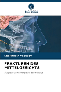 Frakturen Des Mittelgesichts
