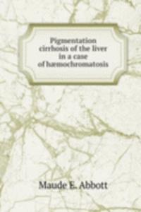 Pigmentation cirrhosis of the liver in a case of haemochromatosis