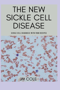 The New Sickle Cell Disease