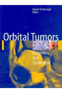 Orbital Tumors: Diagnosis and Treatment