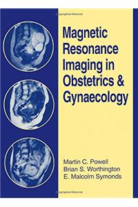 Magnetic Resonance Imaging in Obstetrics and Gynaecology