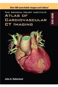 Arizona Heart Institute Atlas of Cardiovascular CT Imaging DVD-ROM