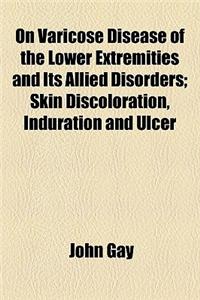 On Varicose Disease of the Lower Extremities and Its Allied Disorders; Skin Discoloration, Induration and Ulcer