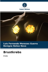 Brustkrebs