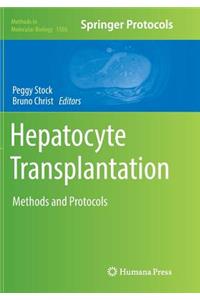 Hepatocyte Transplantation