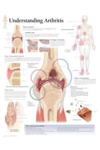 Understanding Arthritis Paper Poster