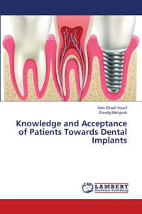 Knowledge and Acceptance of Patients Towards Dental Implants