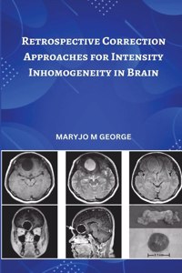 Retrospective Correction Approaches for Intensity Inhomogeneity in Brain