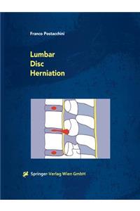 Lumbar Disc Herniation