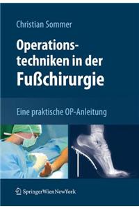 Operationstechniken in Der Fußchirurgie