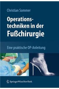 Operationstechniken in der Fußchirurgie