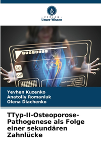 ТTyp-II-Osteoporose-Pathogenese als Folge einer sekundären Zahnlücke