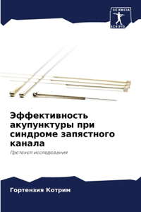 Эффективность акупунктуры при синдроме з