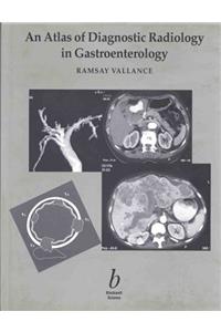 An Atlas of Diagnostic Radiology in               Gastroenterology