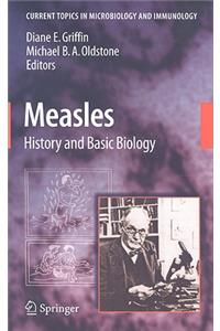 Measles