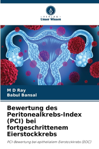 Bewertung des Peritonealkrebs-Index (PCI) bei fortgeschrittenem Eierstockkrebs