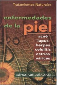 Tratamientos Naturales Para Enfermedades de la Piel