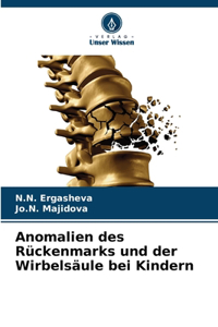 Anomalien des Rückenmarks und der Wirbelsäule bei Kindern