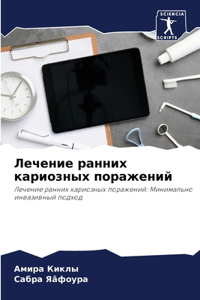 Лечение ранних кариозных поражений