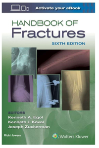 Handbook of Fractures