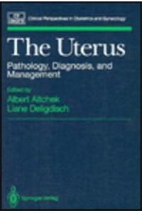 Uterus