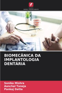 Biomecânica Da Implantologia Dentária