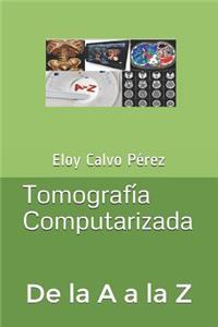 Tomografía Computarizada: De la A a la Z