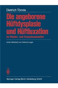 Angeborene Hüftdysplasie Und Hüftluxation Im Kindes- Und Erwachsenenalter