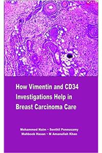 How Vimentin and CD34 Investigations help in Breast Carcinoma Care