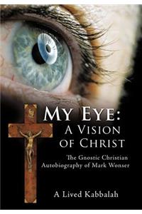 My Eye