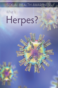 What Is Herpes?