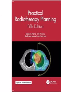 Practical Radiotherapy Planning