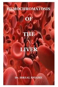 hemochromatosis of the liver