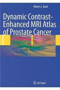 Dynamic Contrast-Enhanced MRI Atlas of Prostate Cancer