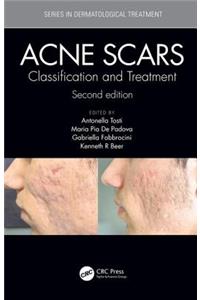 Acne Scars