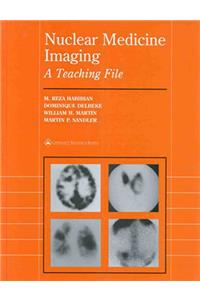 Nuclear Medicine Imaging