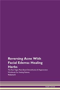Reversing Acne With Facial Edema